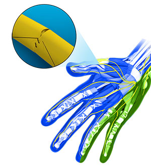 Peripheral Nerves