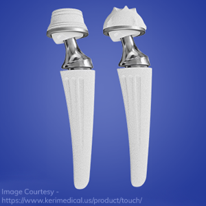 Thumb Joint Replacement with TOUCH Implant