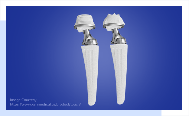 Thumb Joint Replacement with TOUCH Implant