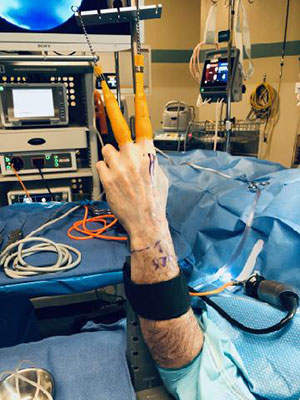 Wrist Arthroscopy